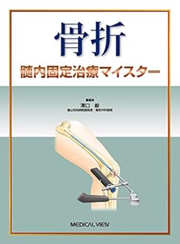 楽天市場】骨折髄内固定治療マイスターの通販